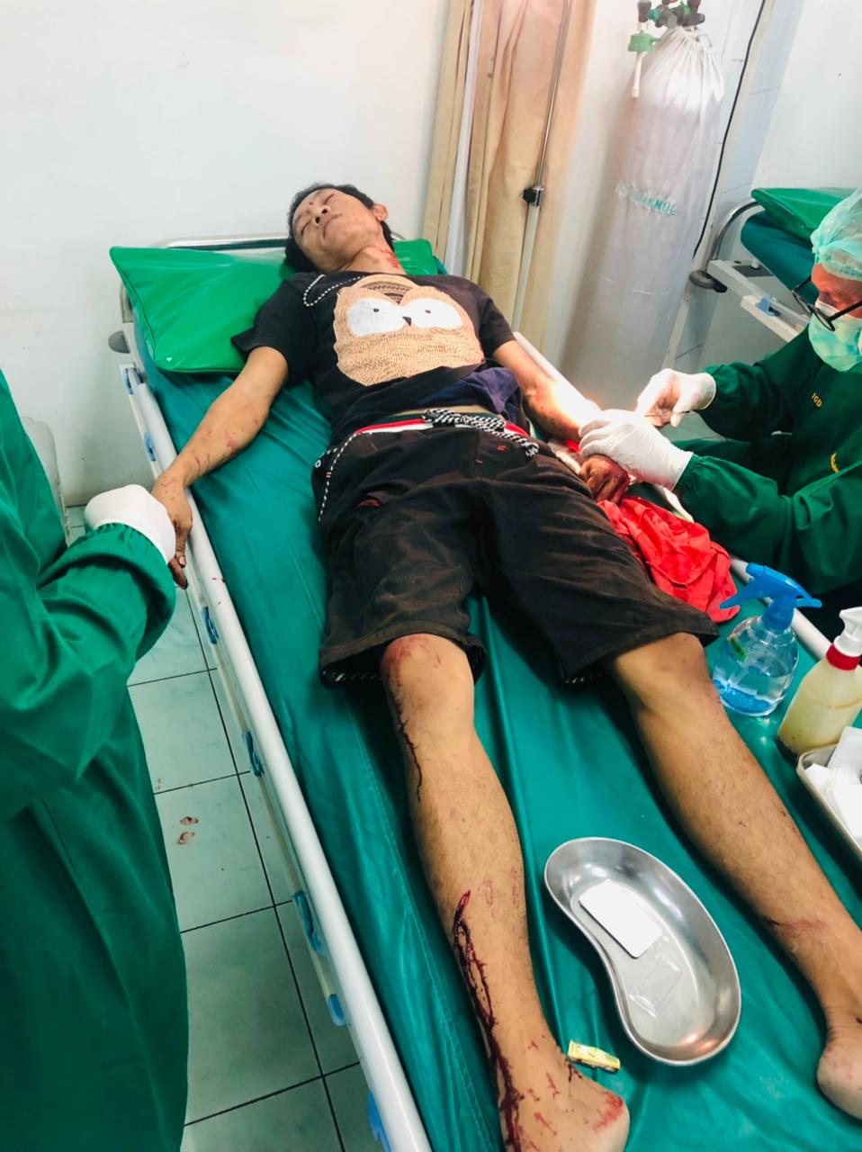 Tawuran Warga di Tanjung Priok Jakut, Satu Orang Pengguna Jalan Terluka Akibat Salah Sasaran